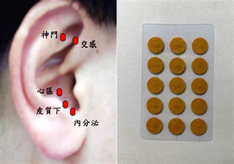 耳穴貼是什麼|【耳穴貼是什麼】耳穴貼是什麼？讓你一次搞懂耳穴貼的功效、原。